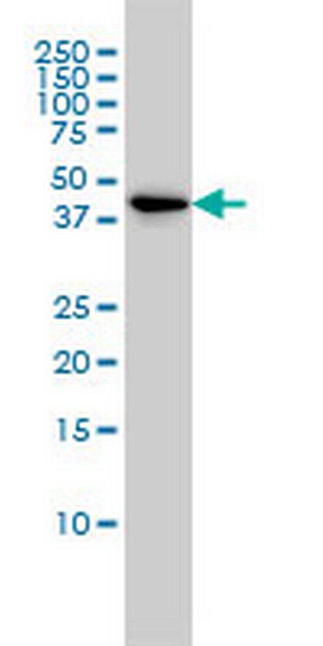 TSC22D4 Antibody in Western Blot (WB)