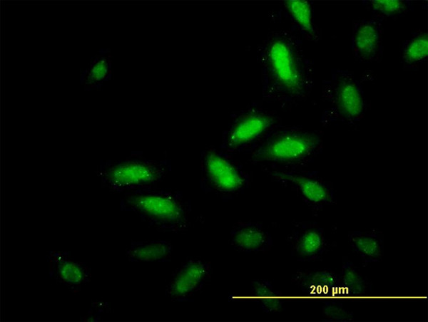 TSC22D4 Antibody in Immunocytochemistry (ICC/IF)