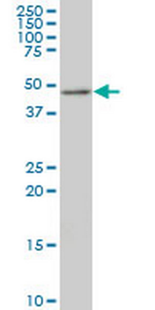 TSC22D4 Antibody in Western Blot (WB)