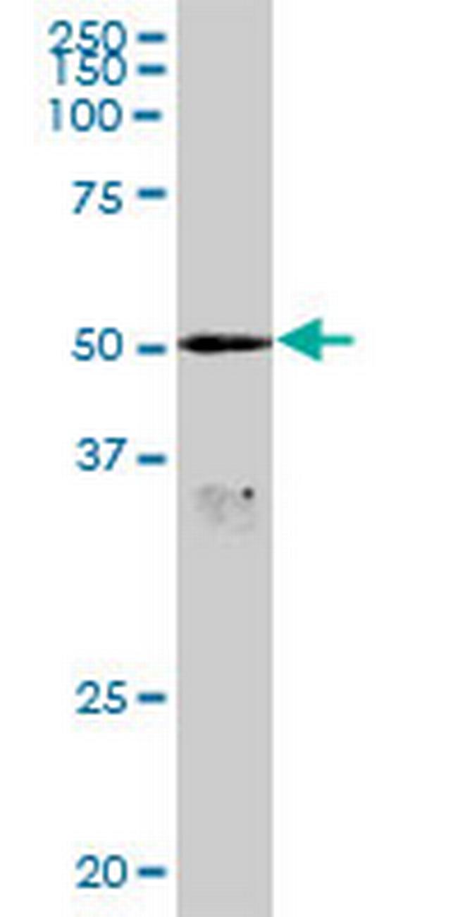 ADPGK Antibody in Western Blot (WB)