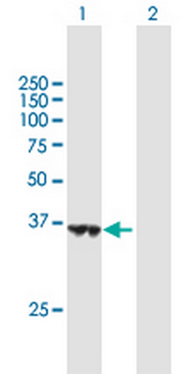 HSDL1 Antibody in Western Blot (WB)