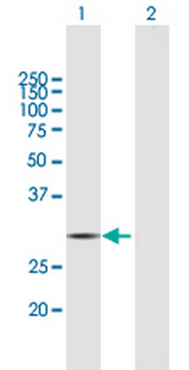 HDHD2 Antibody in Western Blot (WB)