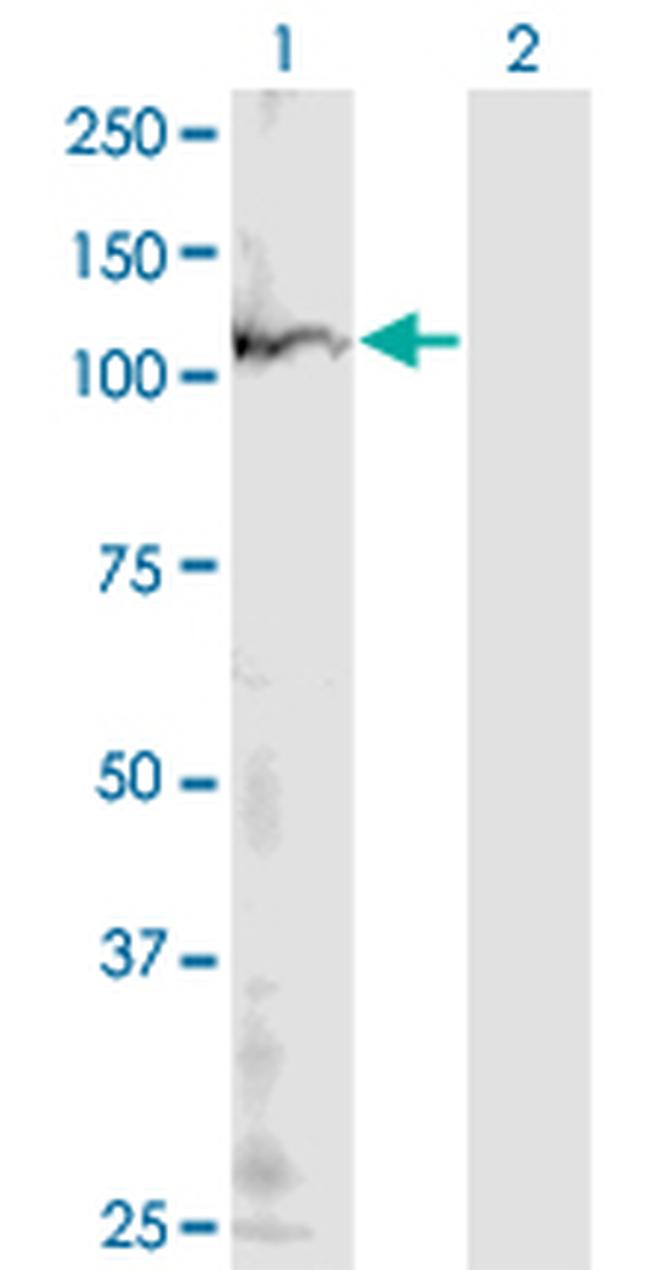 POLR1B Antibody in Western Blot (WB)