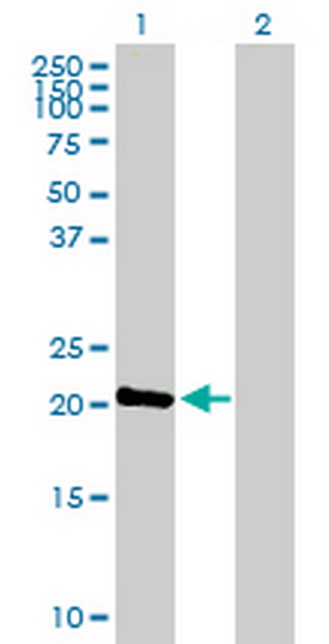 C1orf57 Antibody in Western Blot (WB)