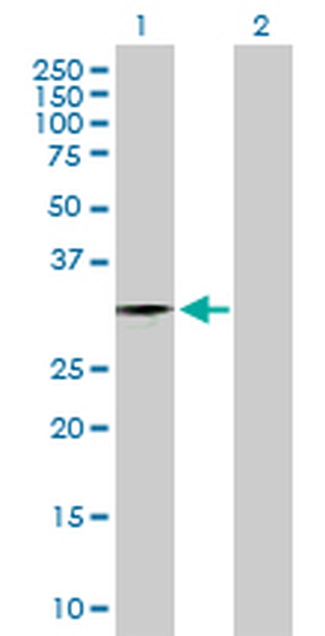 ZNF397 Antibody in Western Blot (WB)