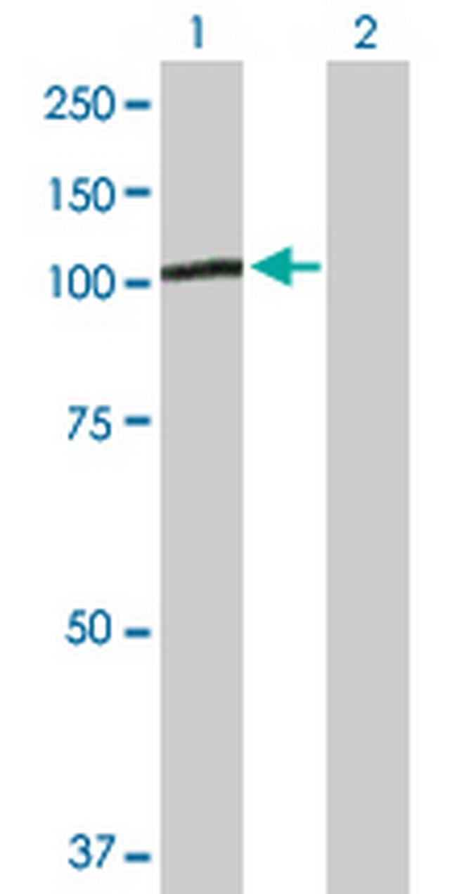 PGBD1 Antibody in Western Blot (WB)