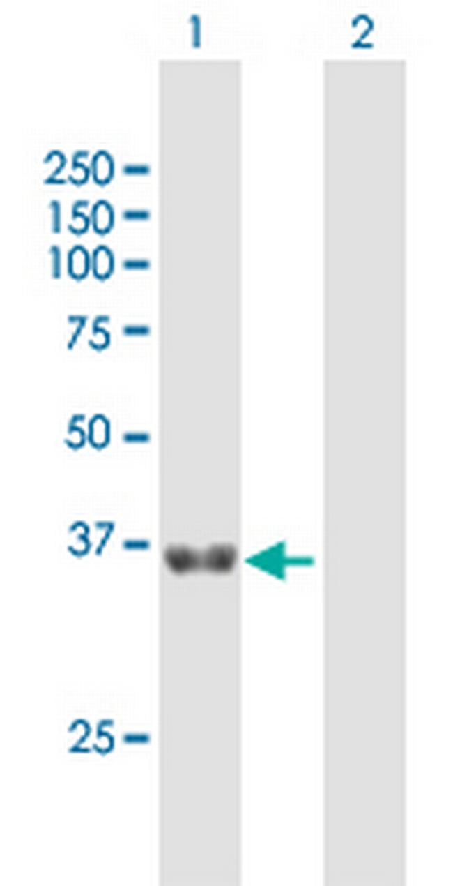 GNPTG Antibody in Western Blot (WB)