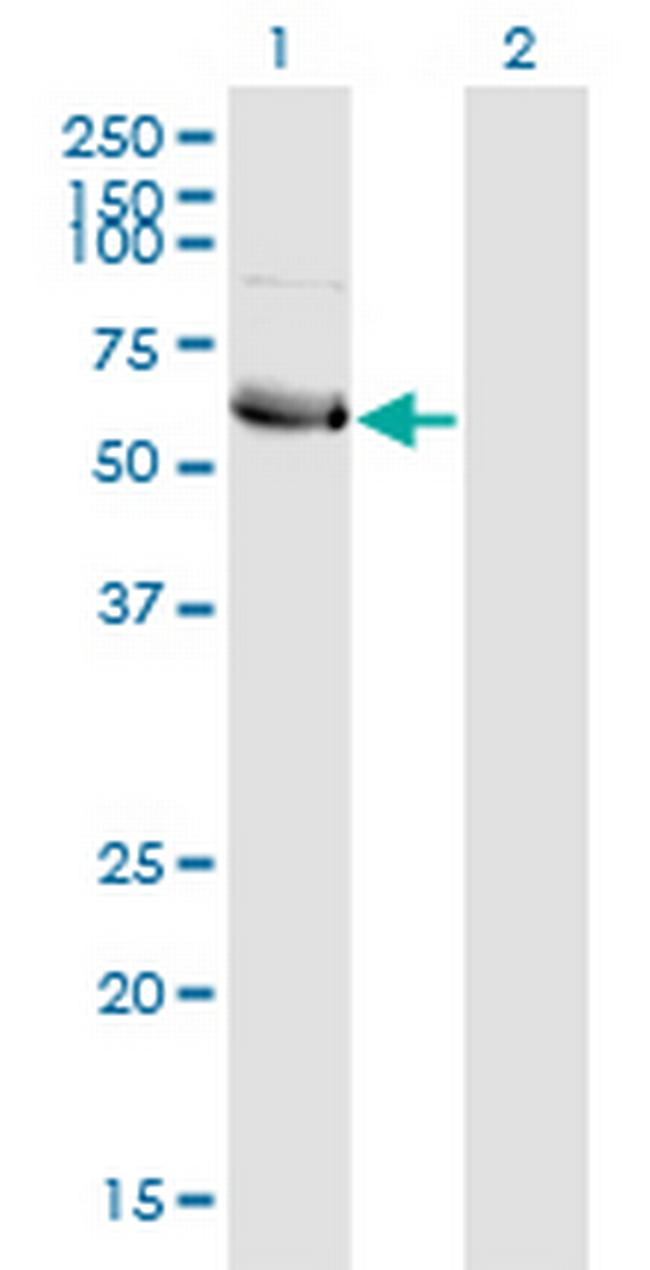 HSFY1 Antibody in Western Blot (WB)