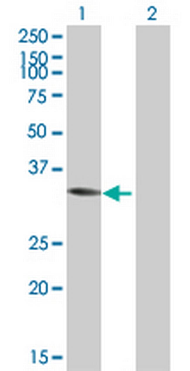 ACY3 Antibody in Western Blot (WB)