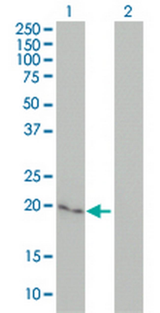 CYGB Antibody in Western Blot (WB)