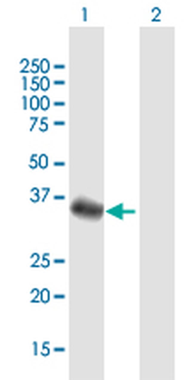 FBXO32 Antibody in Western Blot (WB)