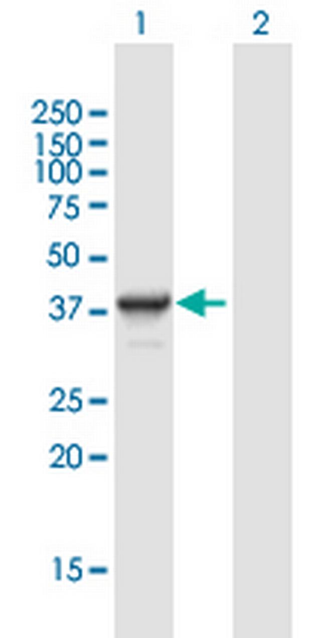 DNTTIP1 Antibody in Western Blot (WB)