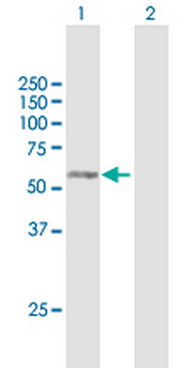 RAB3IP Antibody in Western Blot (WB)