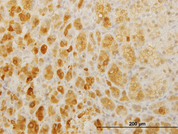 TWIST2 Antibody in Immunohistochemistry (Paraffin) (IHC (P))