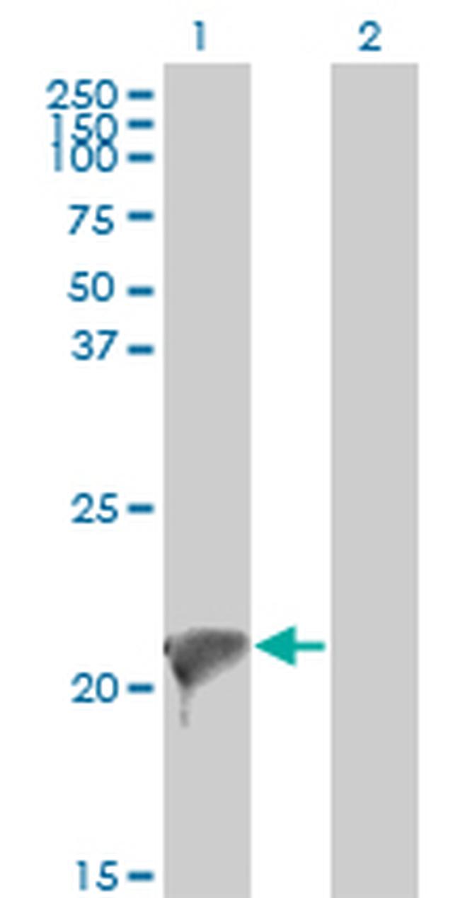 TWIST2 Antibody in Western Blot (WB)