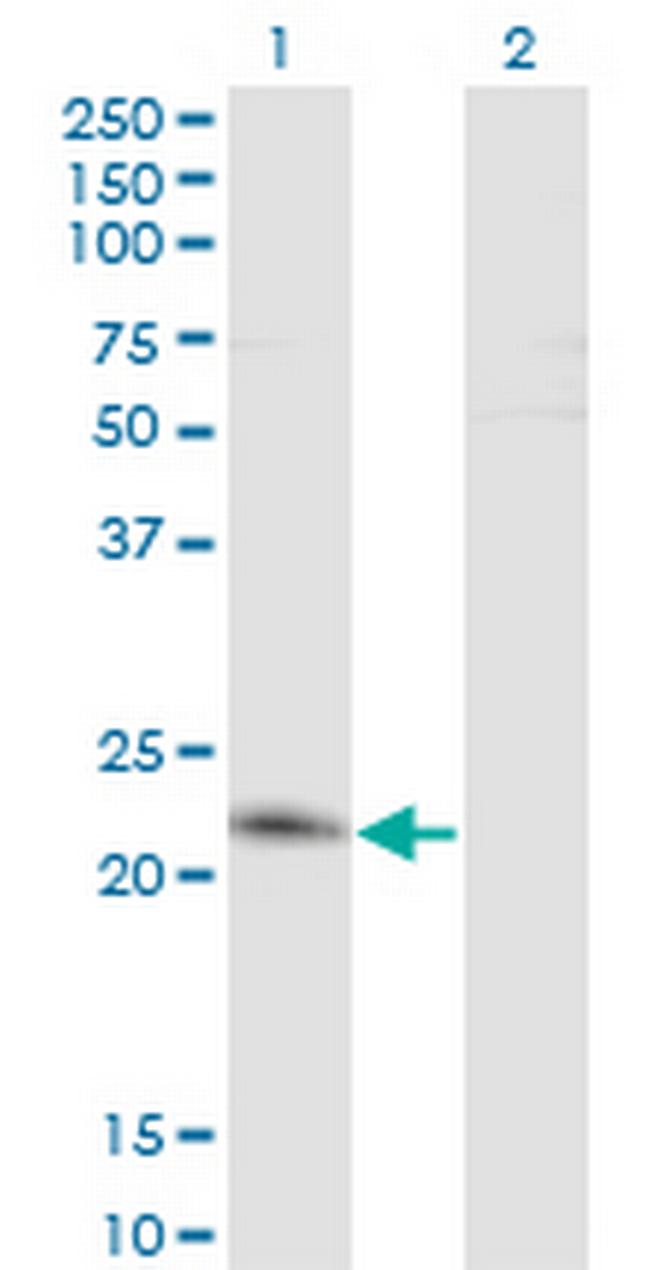 TWIST2 Antibody in Western Blot (WB)