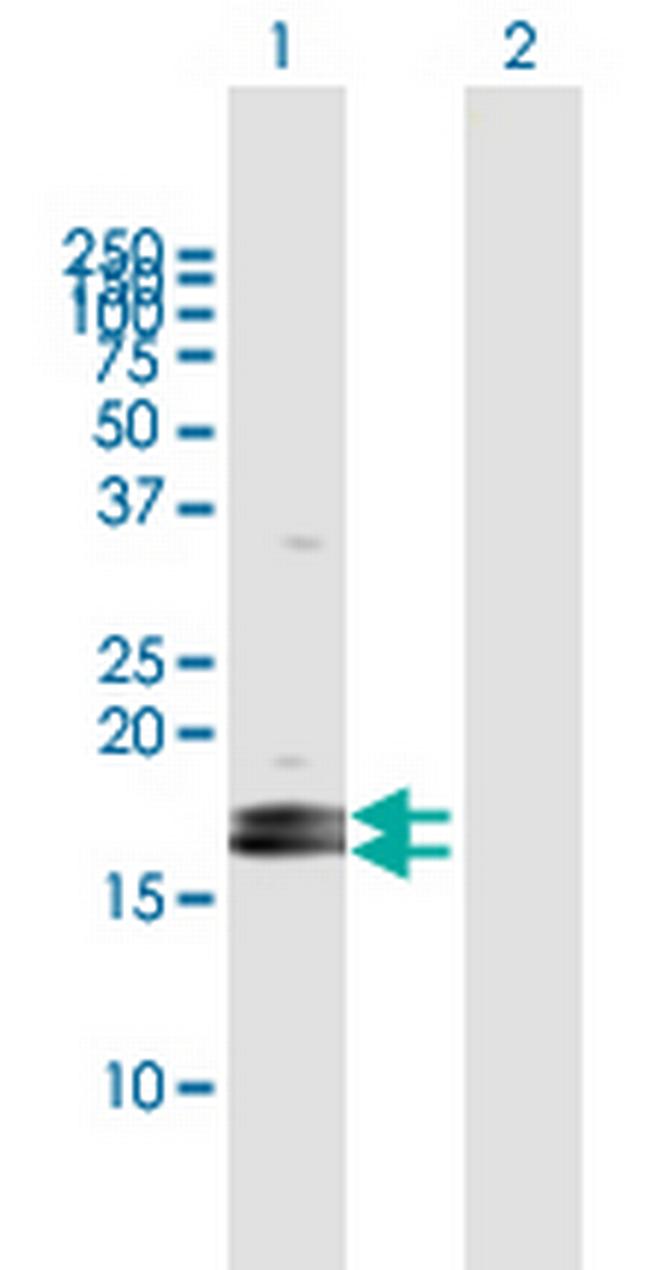 LOC124220 Antibody in Western Blot (WB)