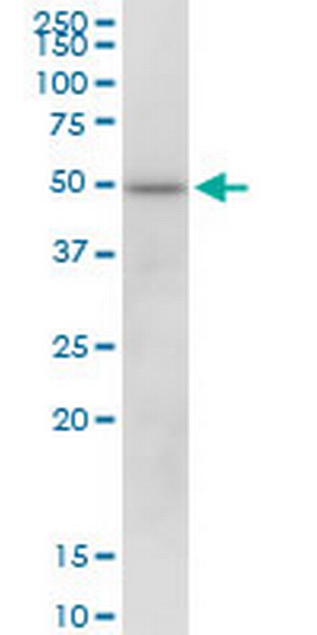 KCTD18 Antibody in Western Blot (WB)