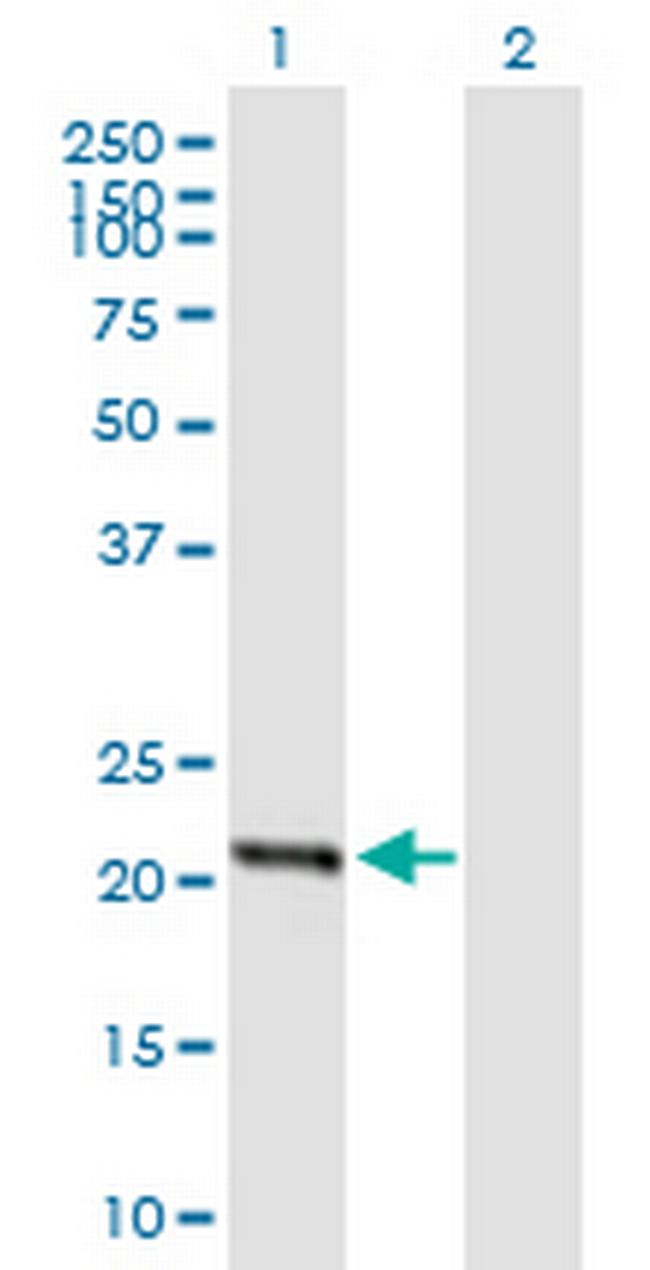 STARD4 Antibody in Western Blot (WB)