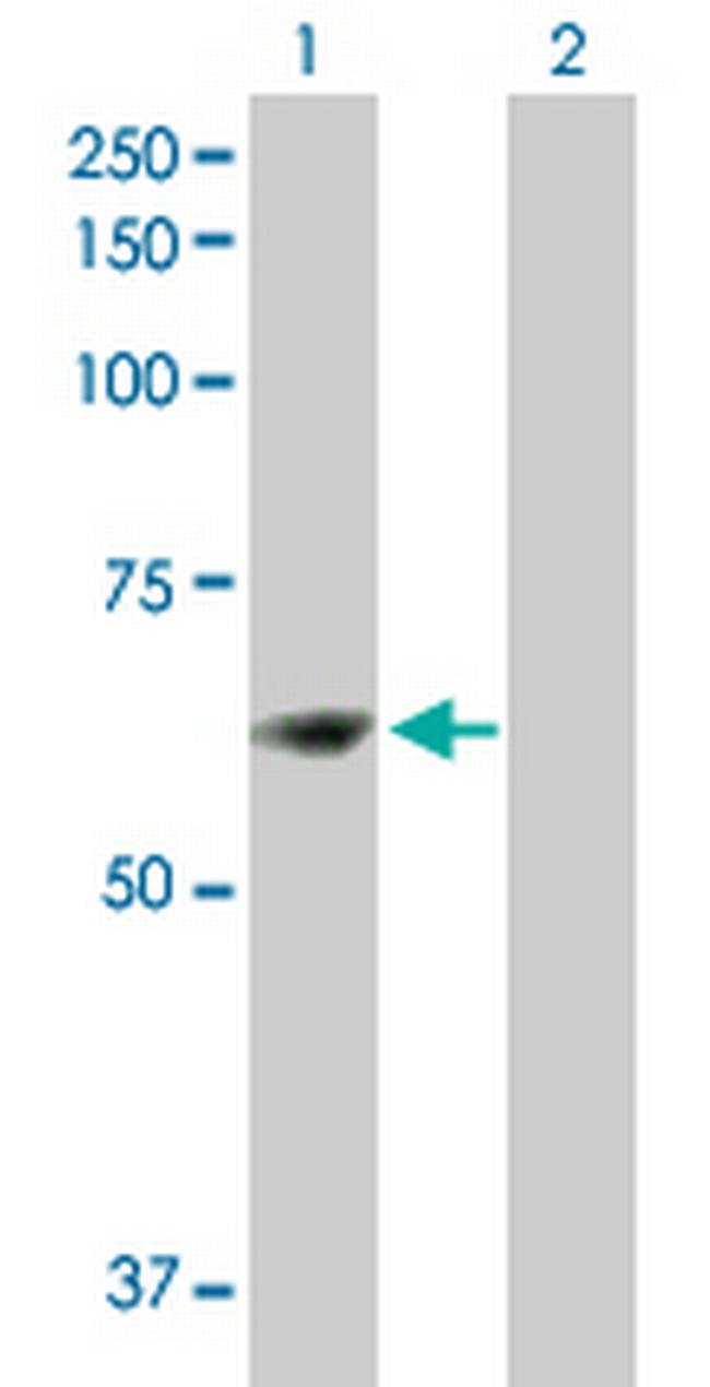 ZNF599 Antibody in Western Blot (WB)