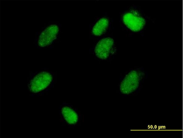 ZFP1 Antibody in Immunocytochemistry (ICC/IF)