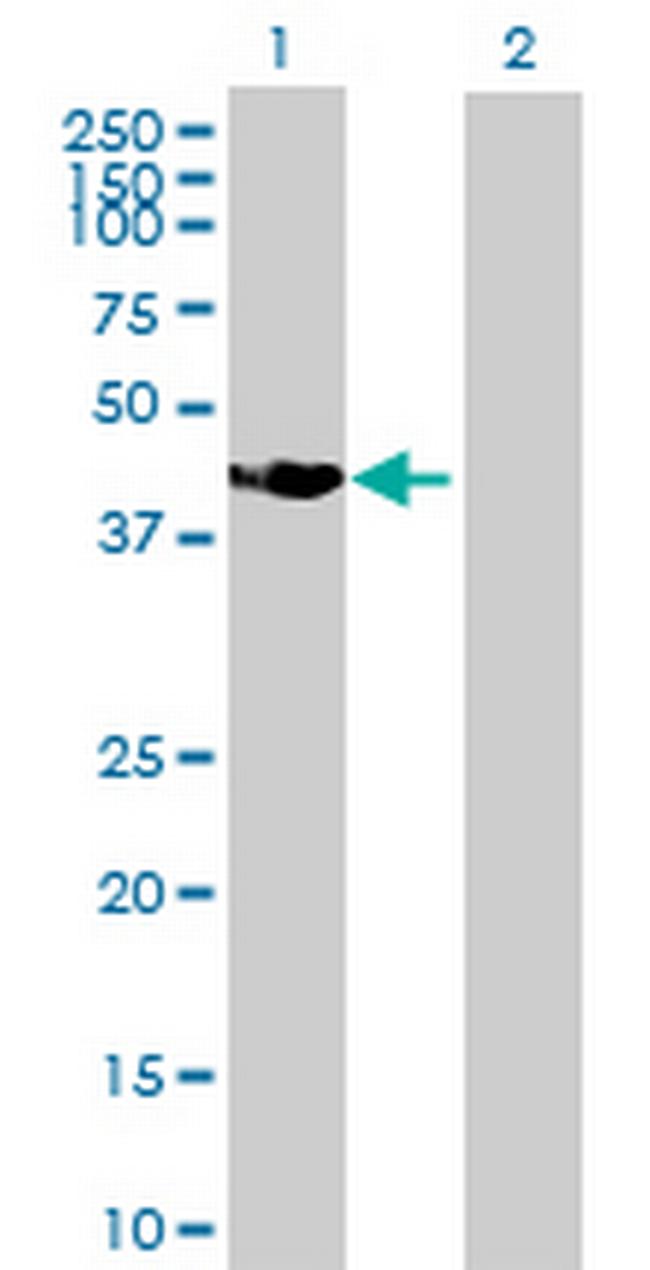 SSBP4 Antibody in Western Blot (WB)