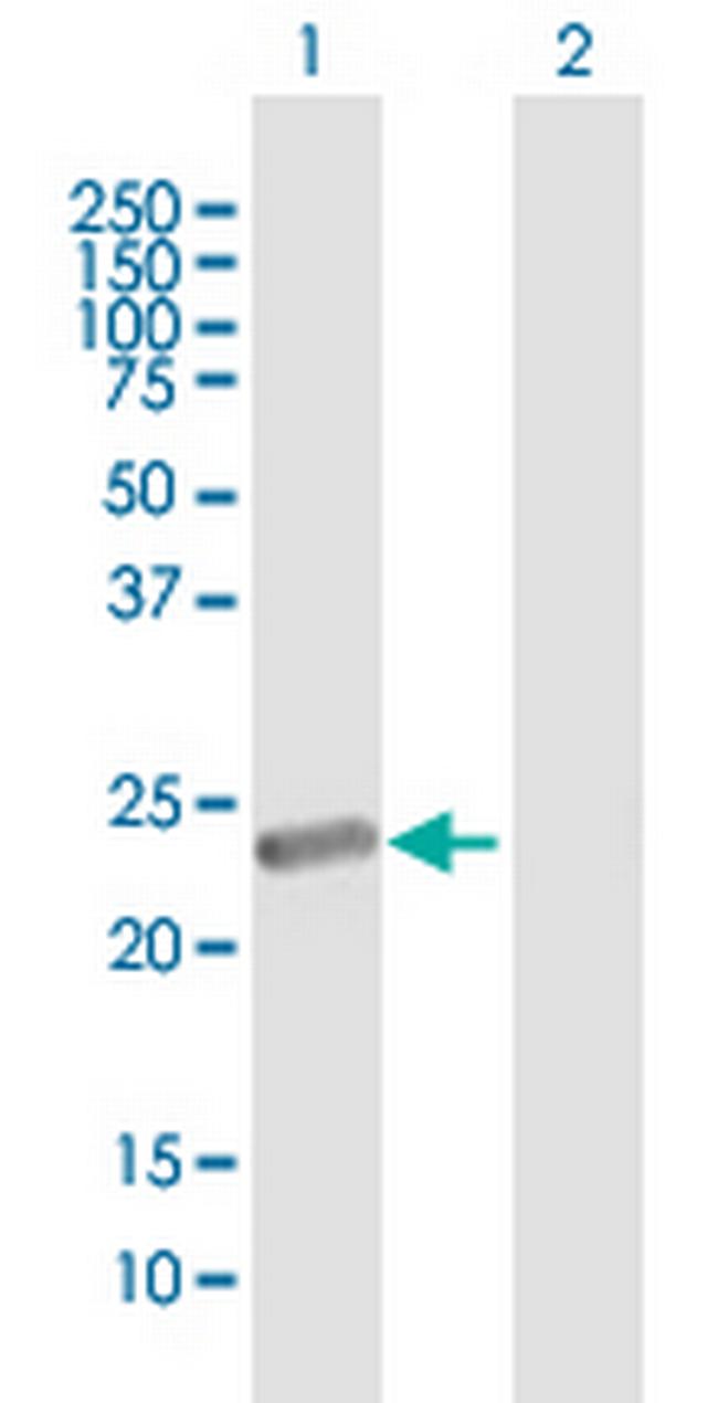 METT5D1 Antibody in Western Blot (WB)