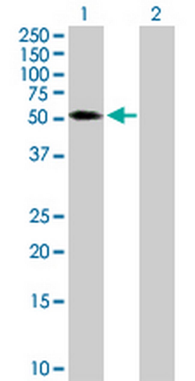 TRIM65 Antibody in Western Blot (WB)