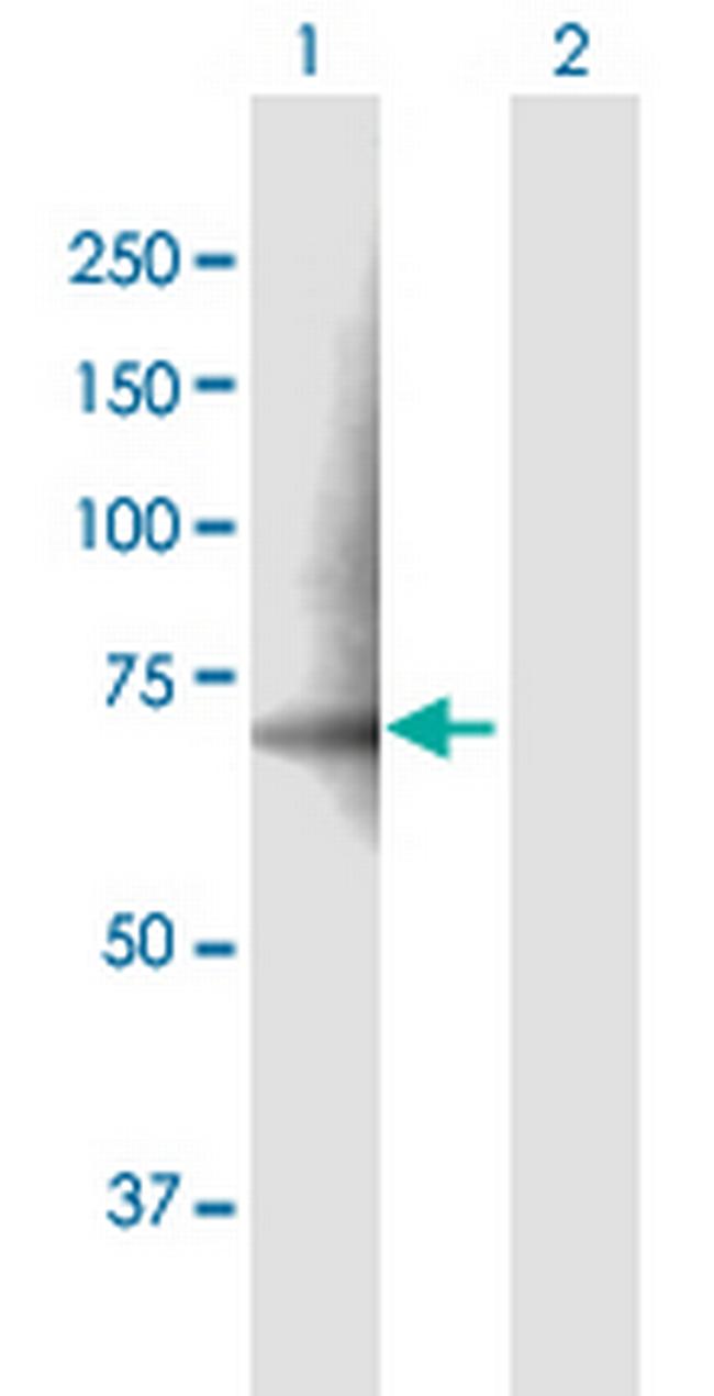 PDE12 Antibody in Western Blot (WB)