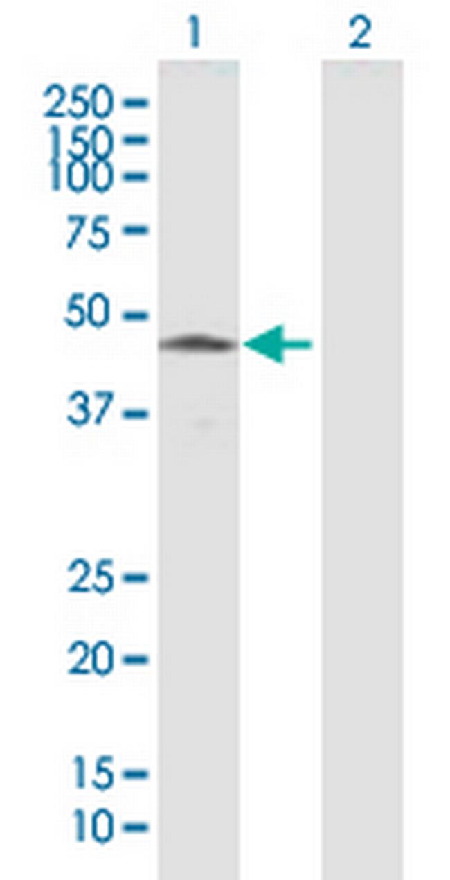 HTRA4 Antibody in Western Blot (WB)