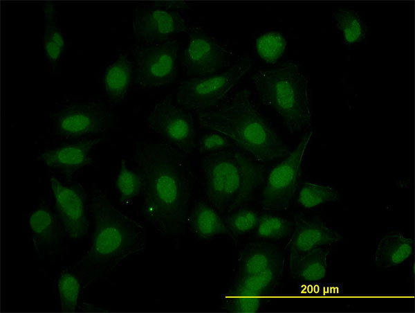 HIPK1 Antibody in Immunocytochemistry (ICC/IF)