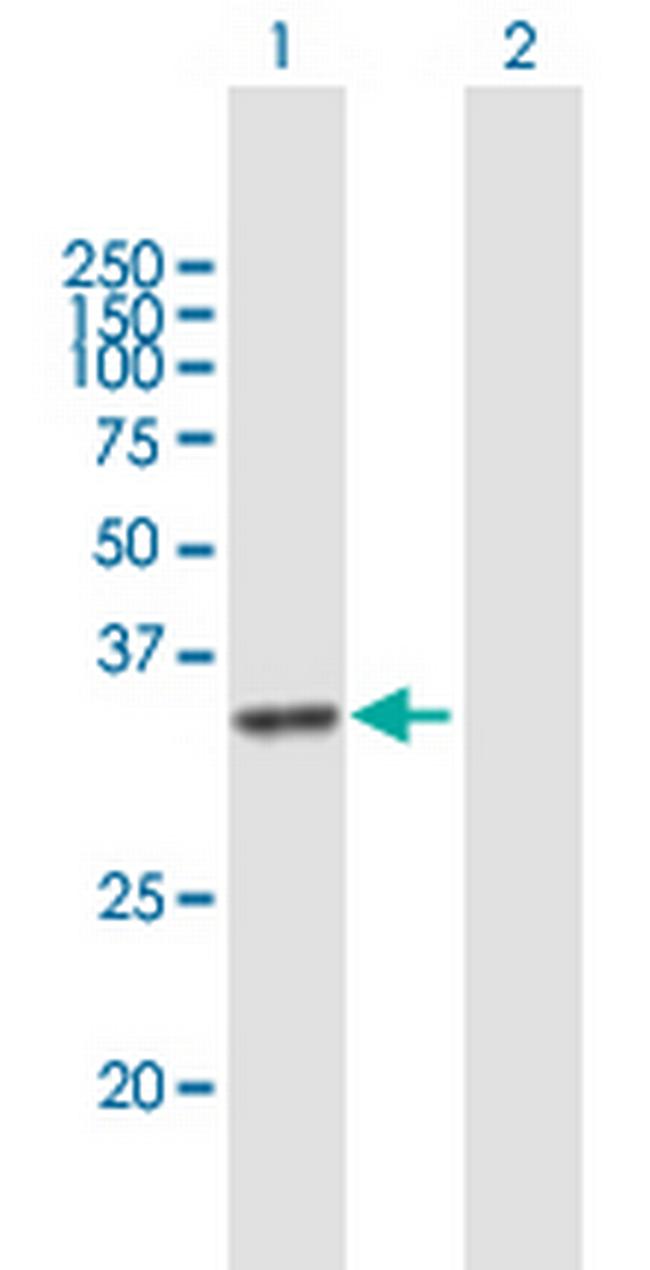 DHRSX Antibody in Western Blot (WB)