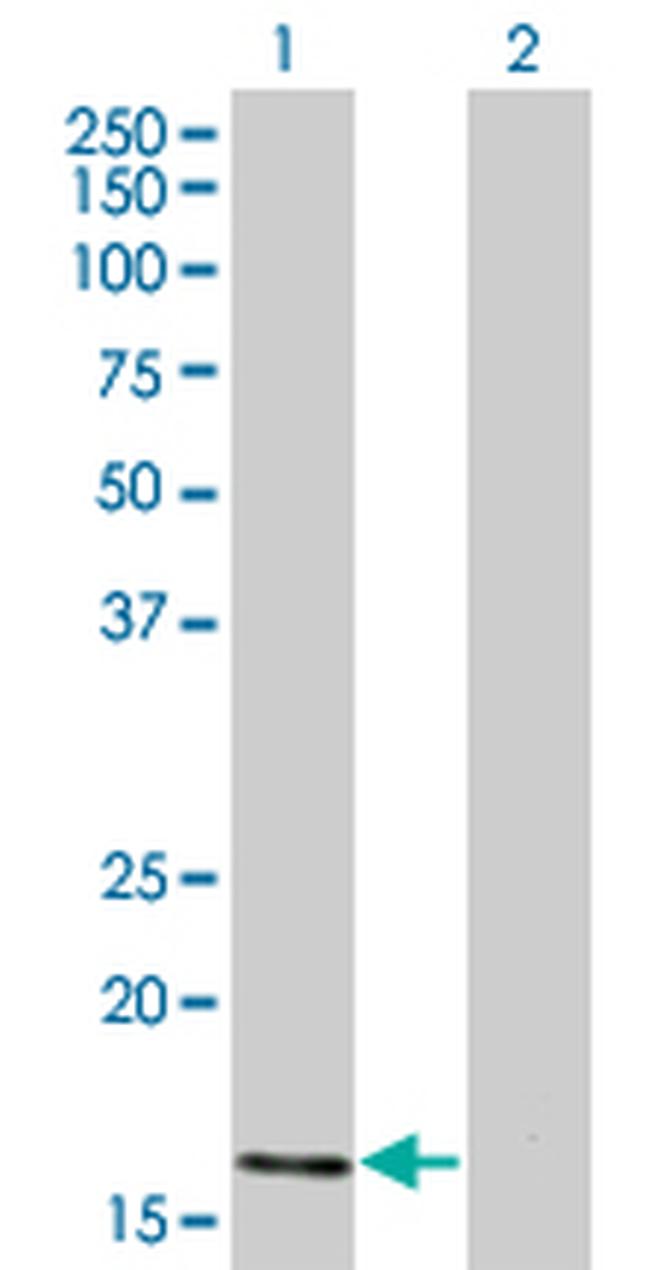 ATOH7 Antibody in Western Blot (WB)