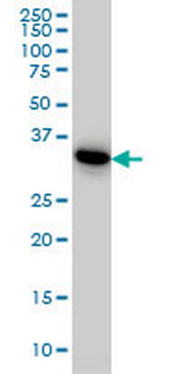 PRPS1L1 Antibody in Western Blot (WB)