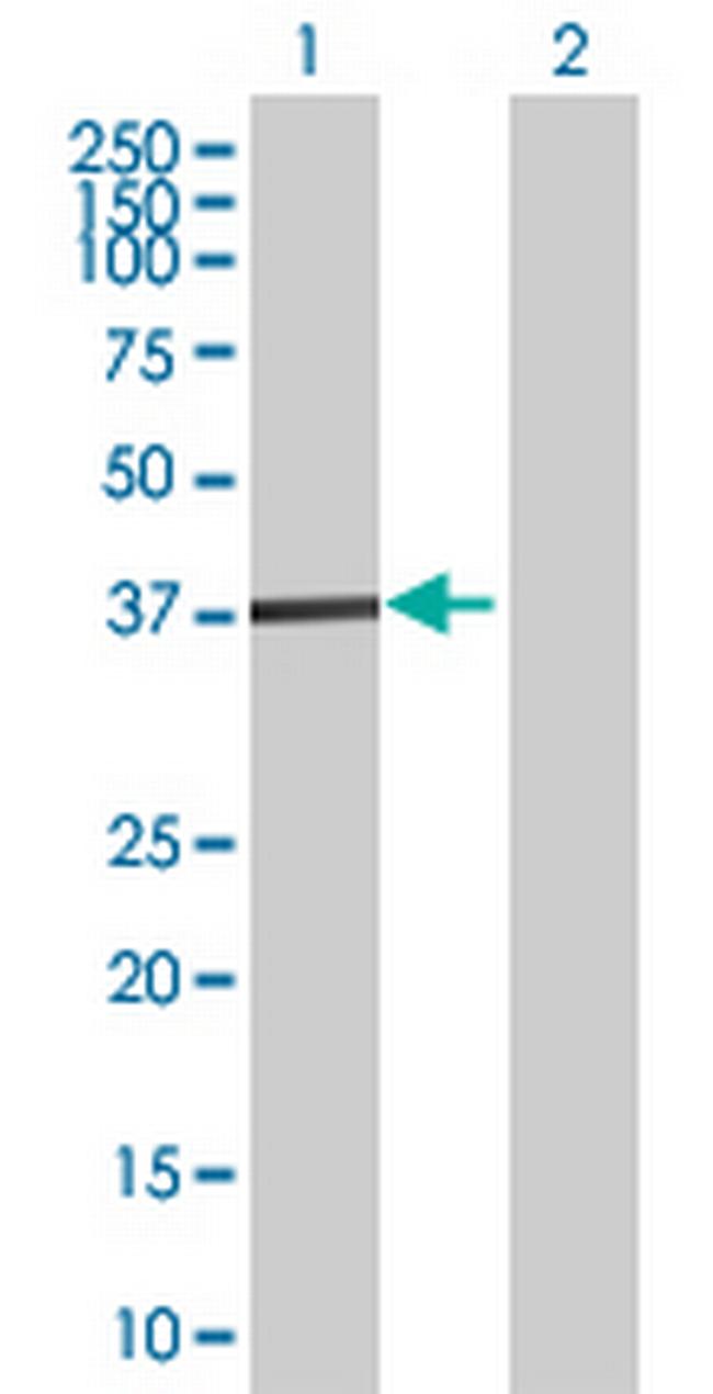 ZNF396 Antibody in Western Blot (WB)