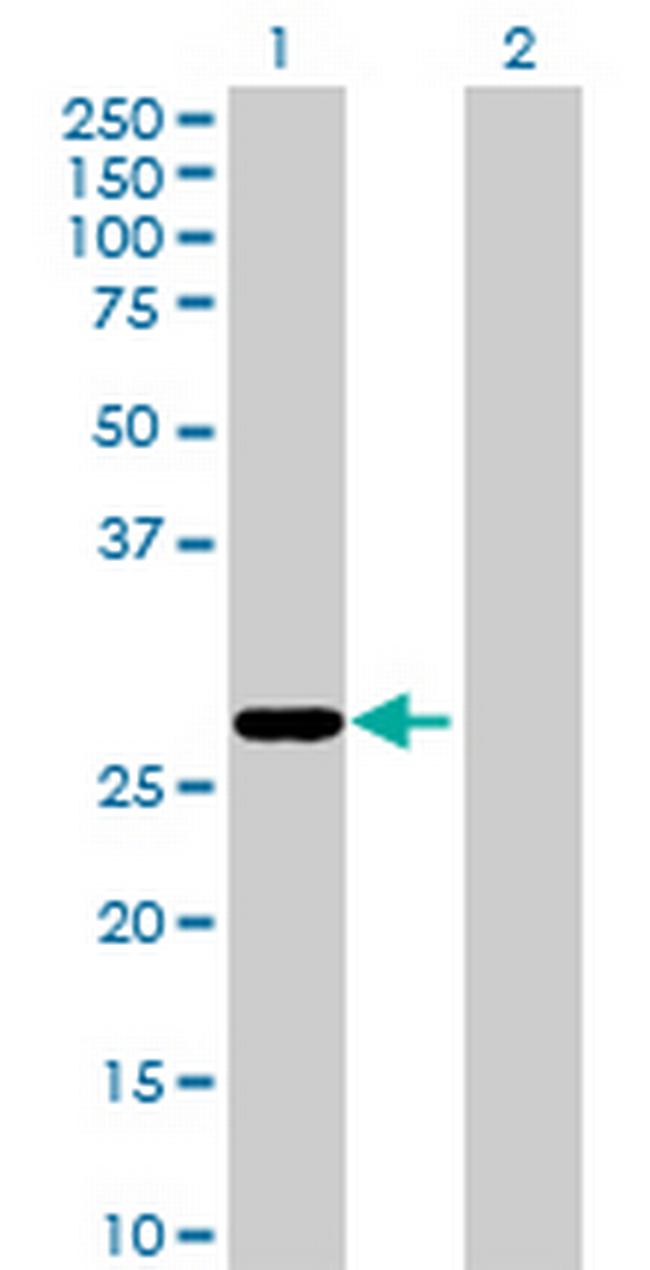 MGC50721 Antibody in Western Blot (WB)