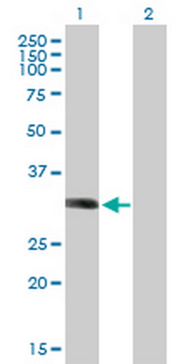 LYSMD2 Antibody in Western Blot (WB)