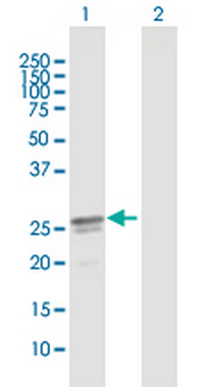 C17orf66 Antibody in Western Blot (WB)