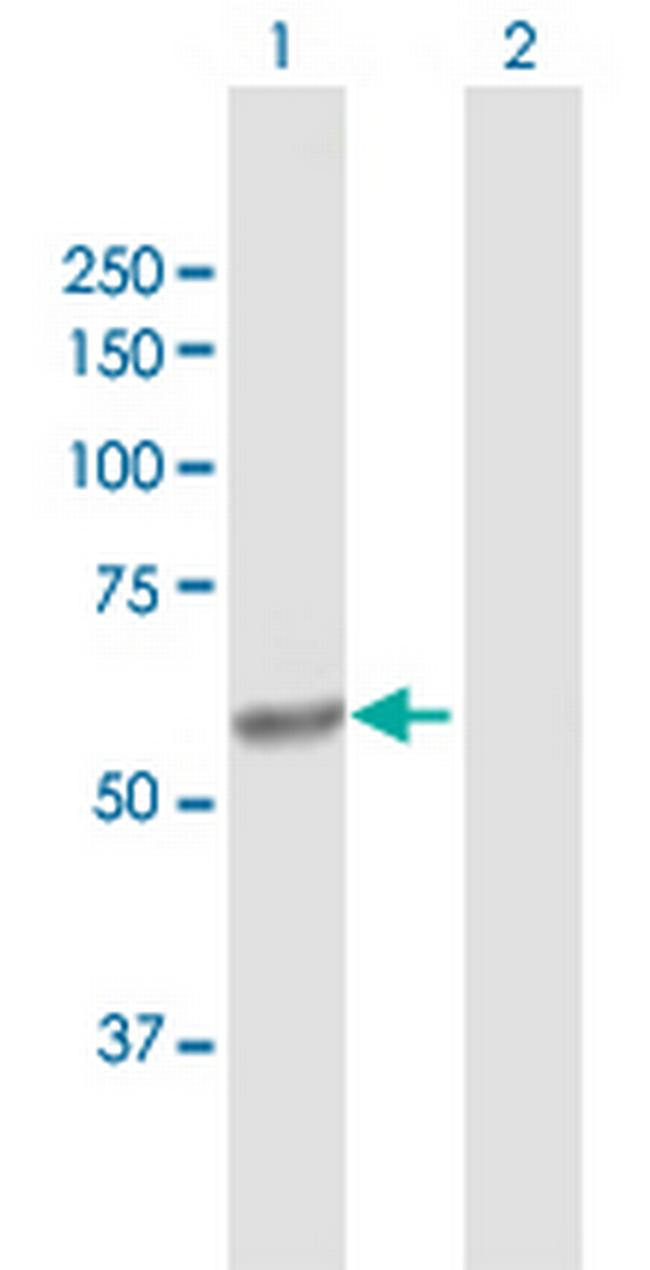 CYP4V2 Antibody in Western Blot (WB)