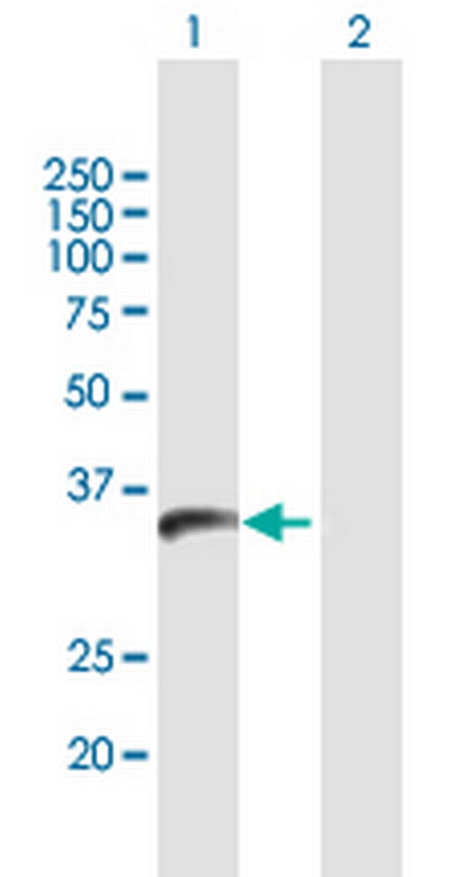 PPIL6 Antibody in Western Blot (WB)