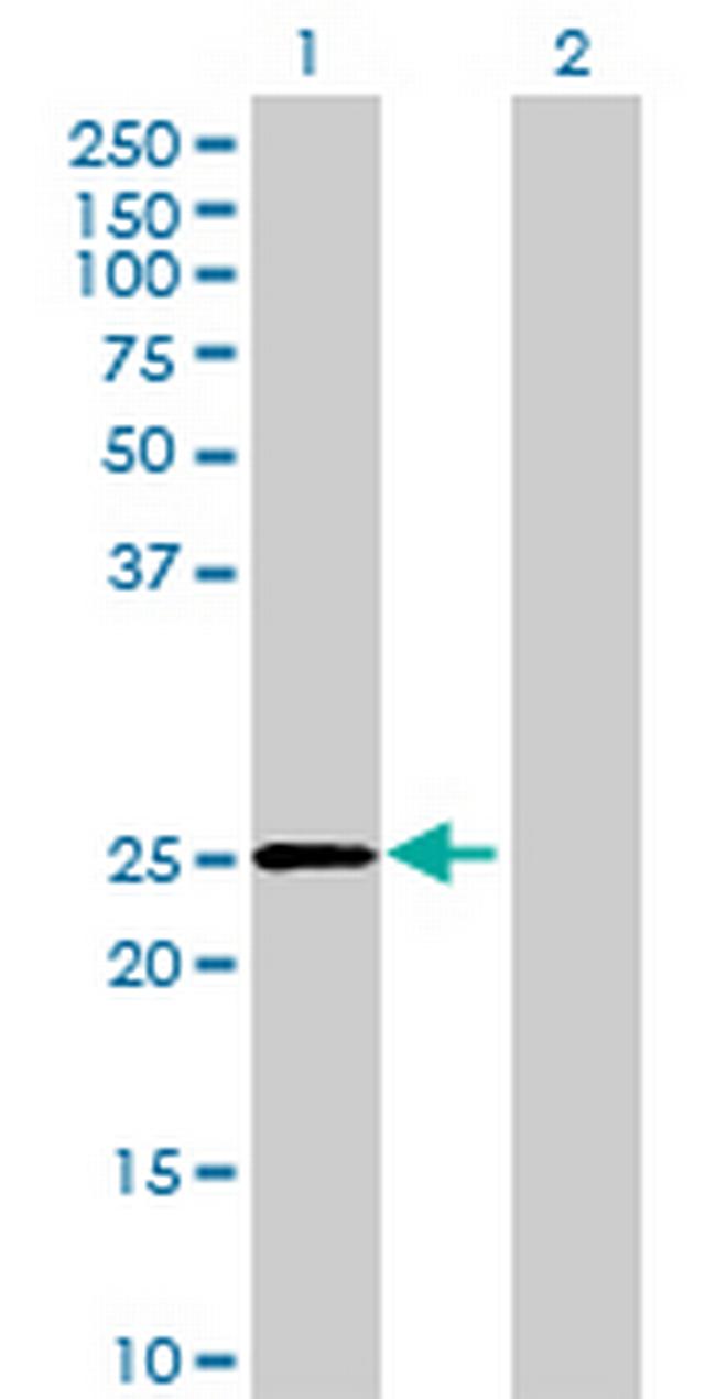 DHRS4L2 Antibody in Western Blot (WB)