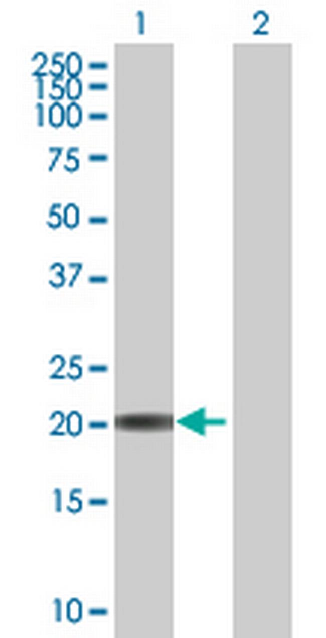 RP11-493K23.2 Antibody in Western Blot (WB)