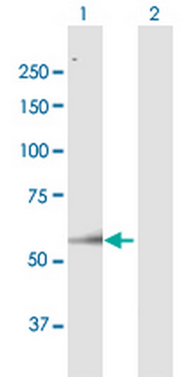 ARSH Antibody in Western Blot (WB)