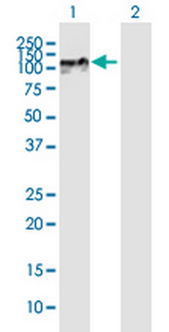 ZNF710 Antibody in Western Blot (WB)