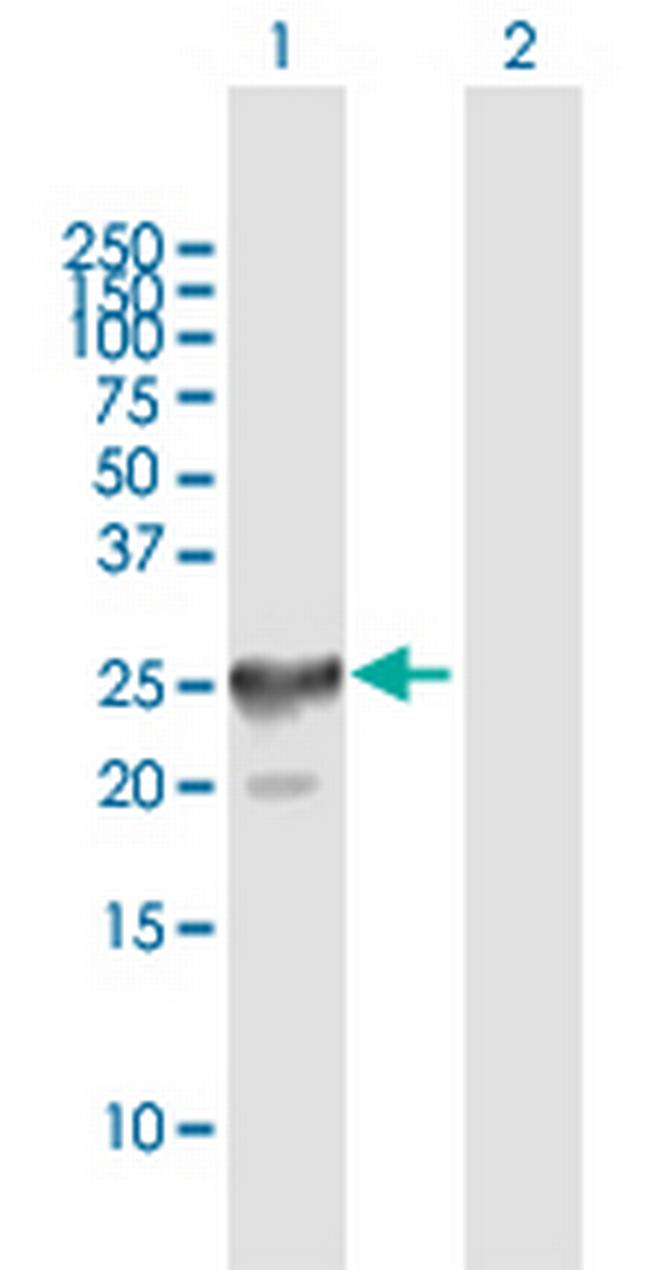 CT45-4 Antibody in Western Blot (WB)