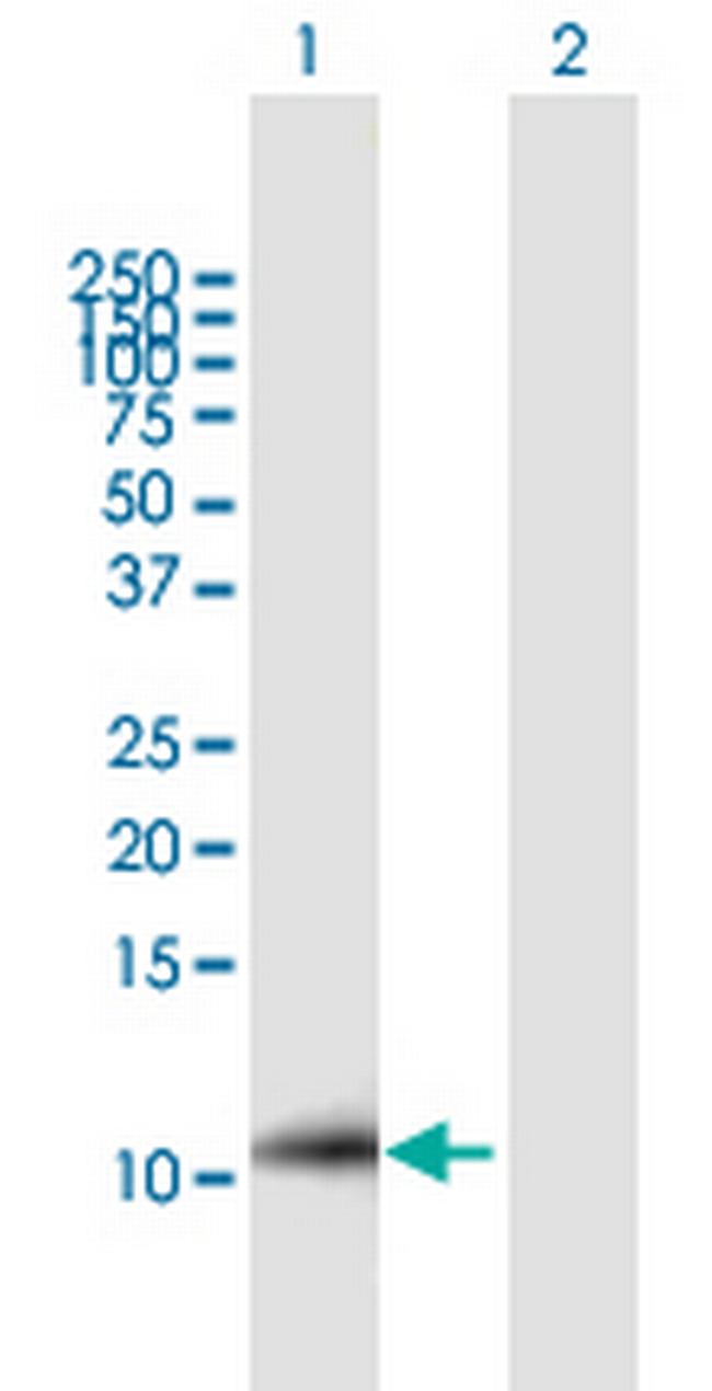 hCG_1731871 Antibody in Western Blot (WB)