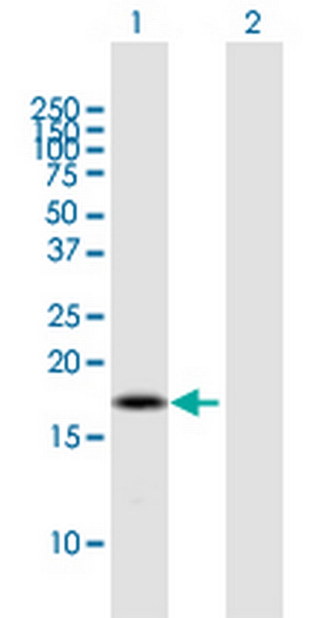 BOLA2B Antibody in Western Blot (WB)