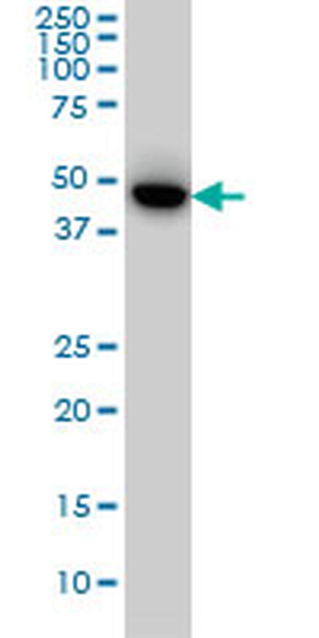 MEF2BNB Antibody in Western Blot (WB)