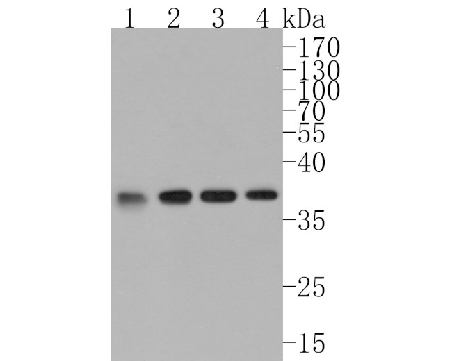 CSNK2A2 Antibody in Western Blot (WB)