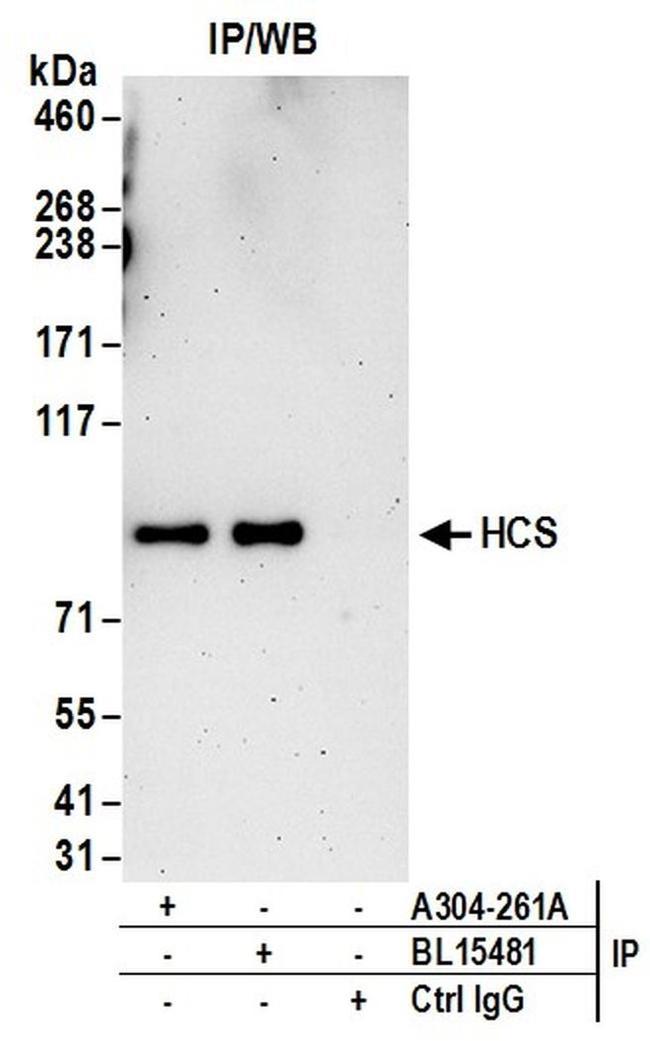 HCS Antibody in Western Blot (WB)